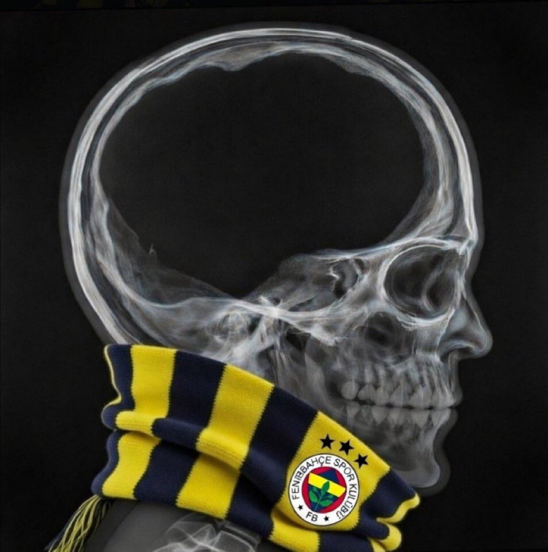 GSAliSamiyenBey's tweet photo. Ben bir şey demiyorum adam fenerbahçeli siz zaten anladınız. https://t.co/F8fQVe3Kxg
