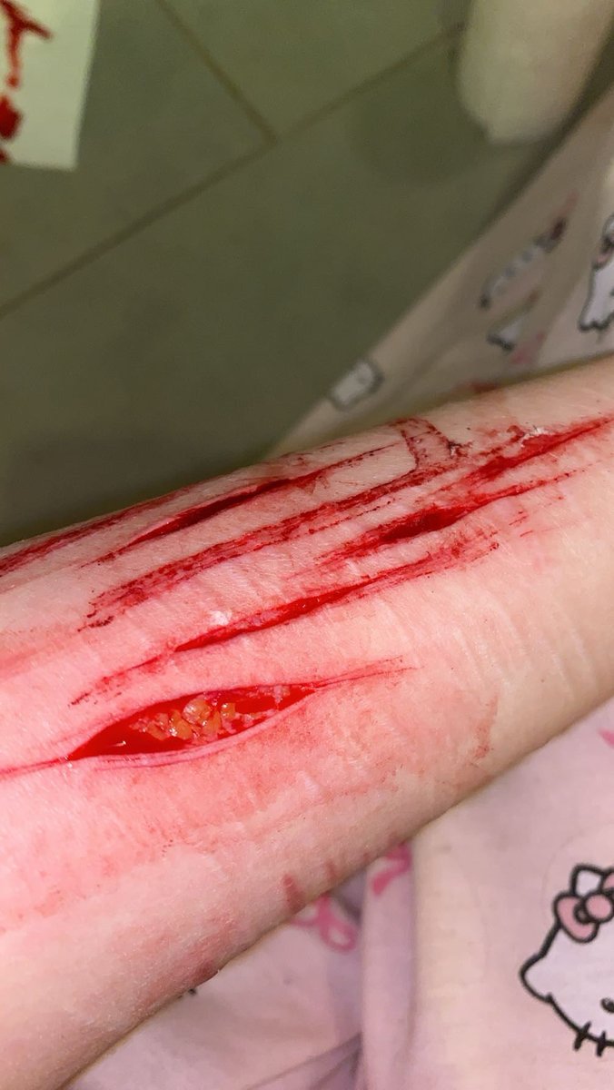 famous_prophett's tweet photo. i love multiswipinggg #shedtwt #beanshtwt #babybeans #slittwt #selfharm https://t.co/XlIGDbaQrm