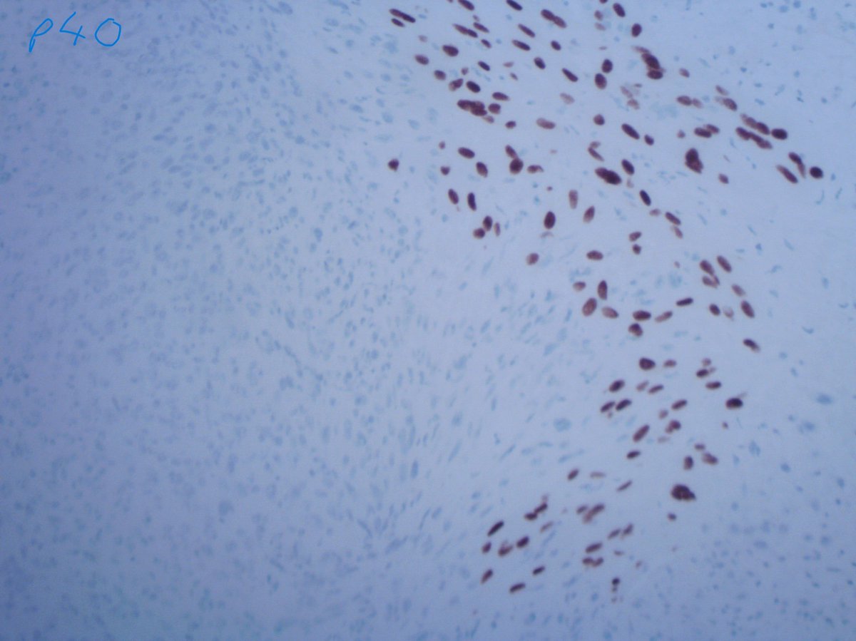 Tim Bracey tweet media