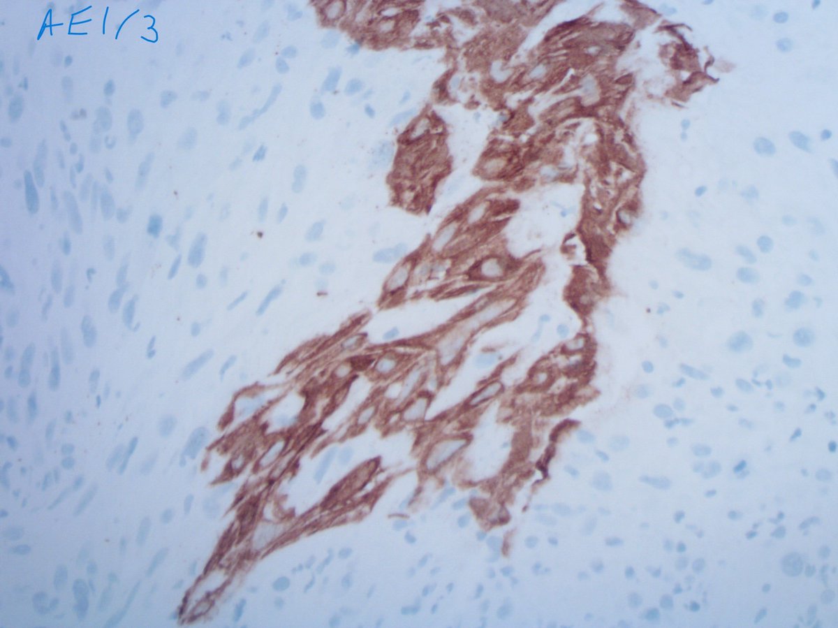 Tim Bracey tweet media