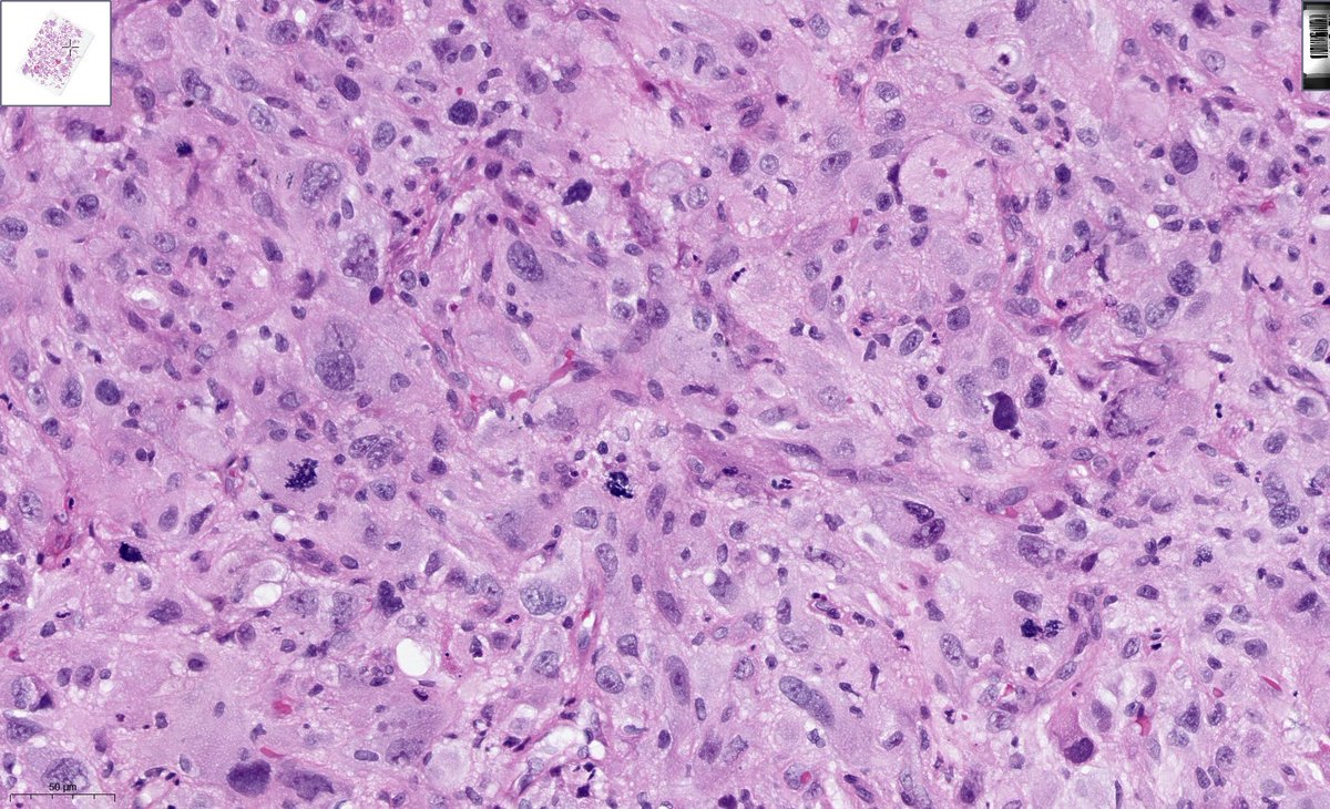 Tim Bracey tweet media