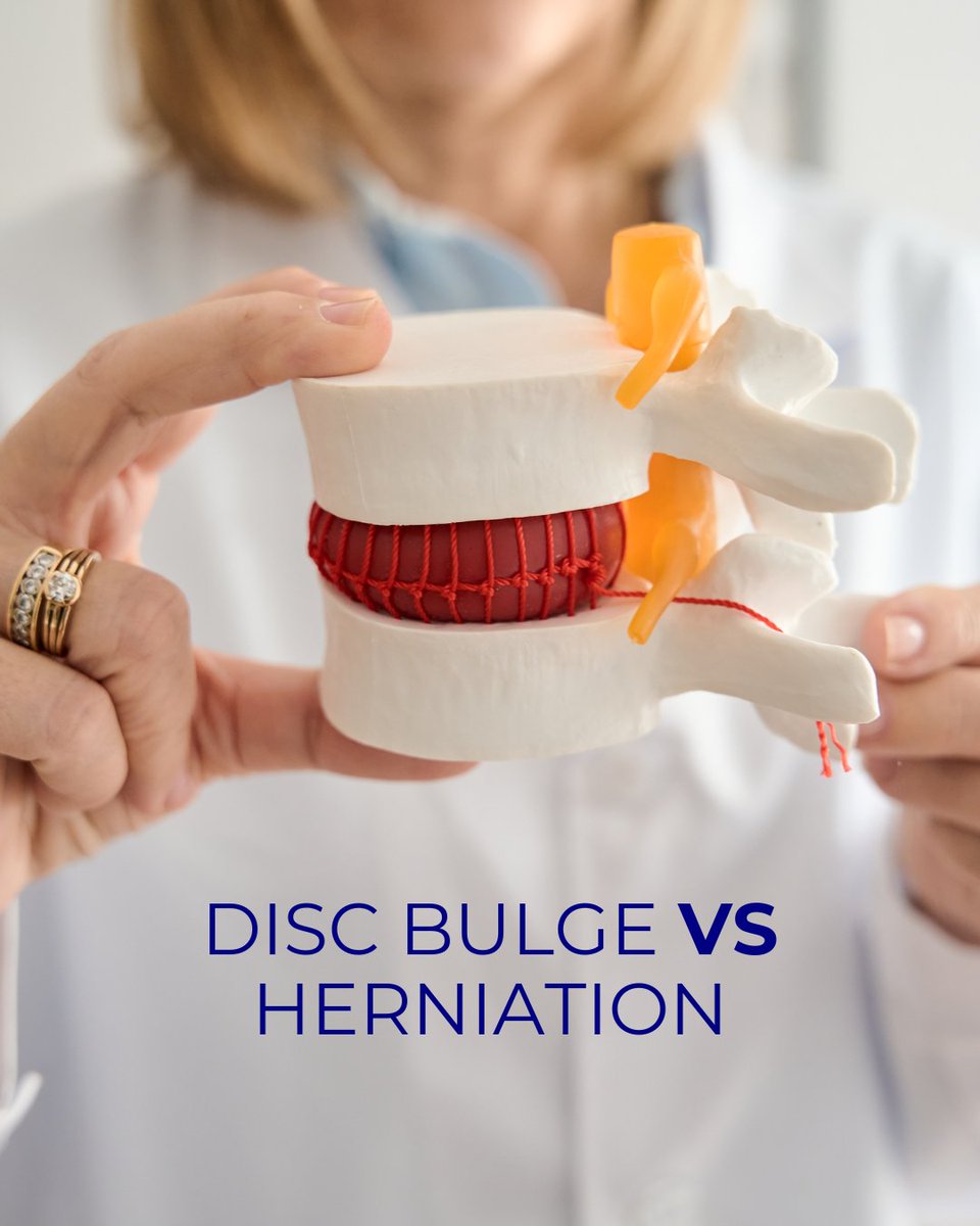 JDchiro's tweet image. Bulge or herniation — pressure is the real problem.
Spinal decompression helps relieve it naturally.
👉 Book your consultation today.
#BackPainRelief #SpinalDecompression #SciaticaHelp #NonSurgicalHealing