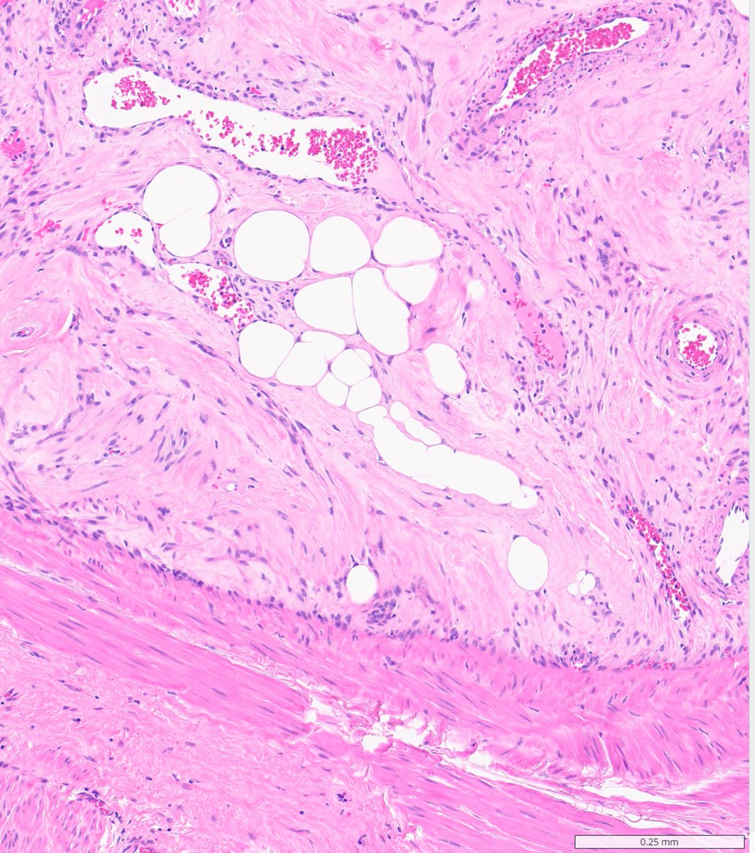 MeredithKHerman's tweet image. #TooClosetoDiagnose ?

Hints: 🪱🩸💪♀️

#PathX #PathQuiz #GynPath