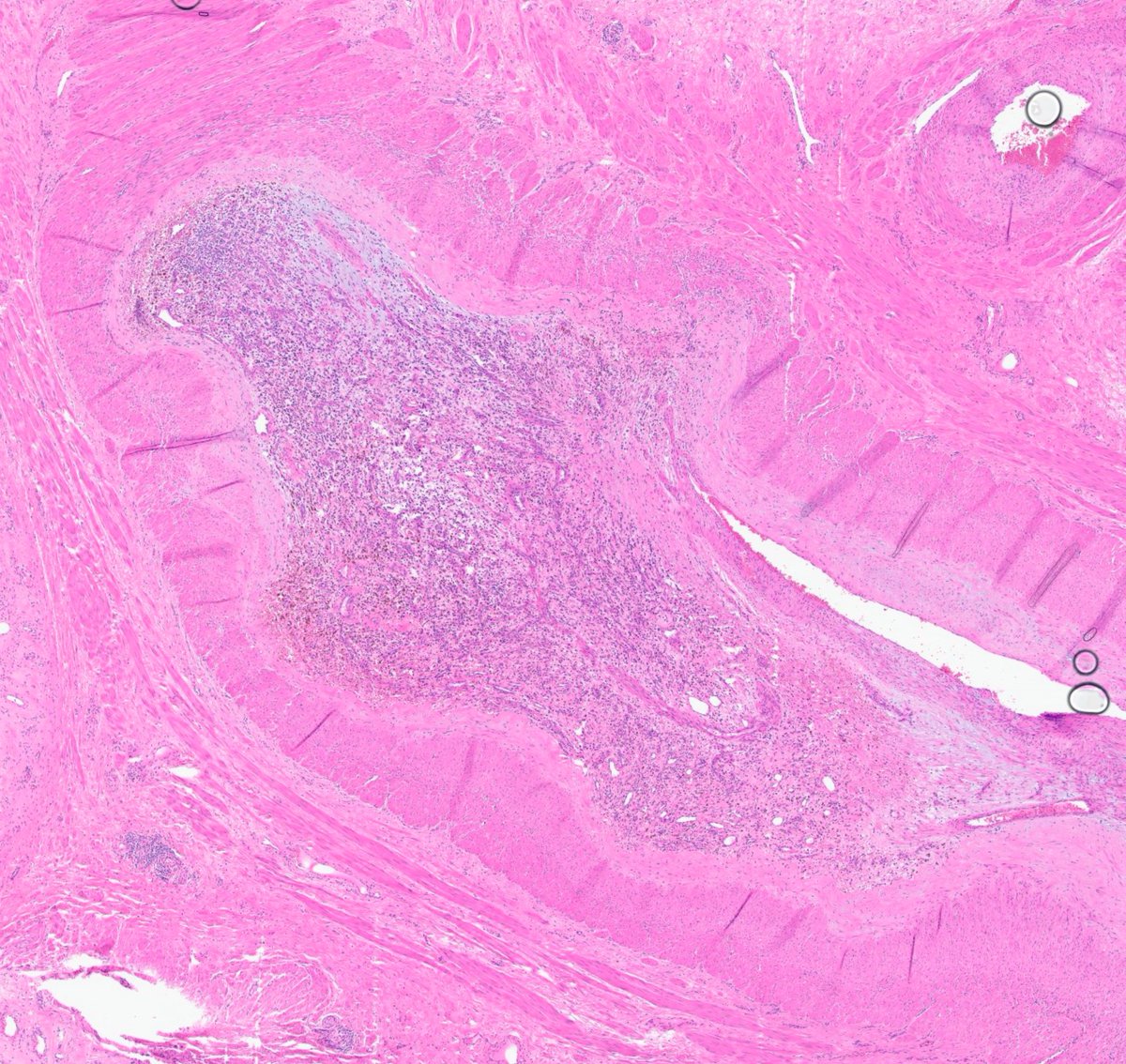 MeredithKHerman's tweet image. #TooClosetoDiagnose ?

Hints: 🪱🩸💪♀️

#PathX #PathQuiz #GynPath
