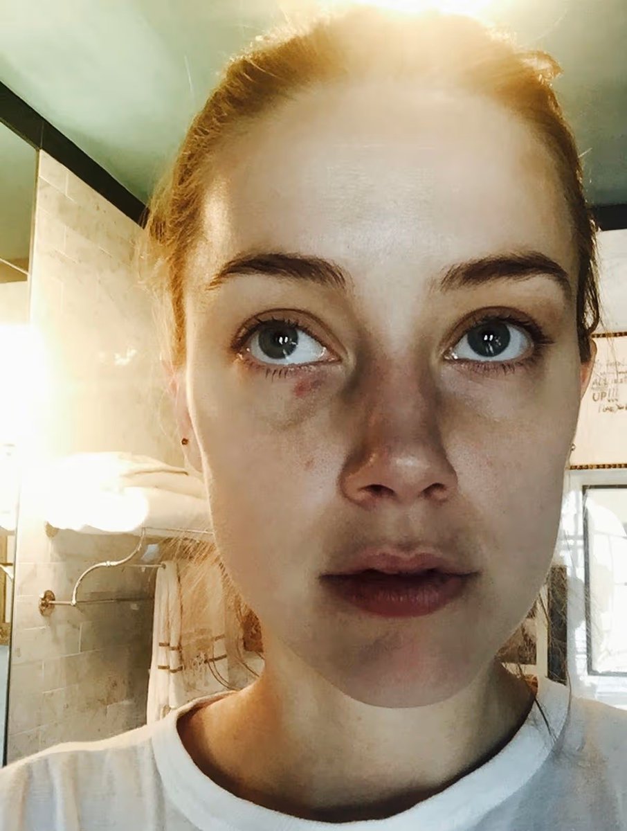 TeresaCSilvaR's tweet photo. Heard's "overwhelming evidence" that she was brutally assaulted and Depp was extremely violent...
Make it make sense
This is not rocket science
Depp deserves a public apology.
#FalseAllegations
#PathologicalLying https://t.co/eYiSkbxZl9
