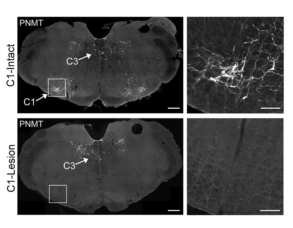 CircRes's tweet image. Souza &amp;amp; colleagues identify a small group of #brainstem neurons that help stabilize #BloodPressure in response to arousal and physical activity. Learn more at ahajrnls.org/4u2lUFh