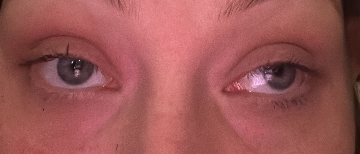 а$е4к@ tweet media