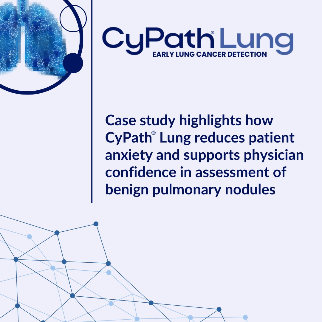 $BIAF New case study: CyPath® Lung spares 79yo woman invasive biopsy for suspicious nodule — supports surveillance over risky procedure. Noninvasive test w/ 92% sensitivity &amp; 87% specificity for early lung cancer detection. Tiny 4.3M float, NFS DYOR #BIAF #LungCancer #biotech ⚕️