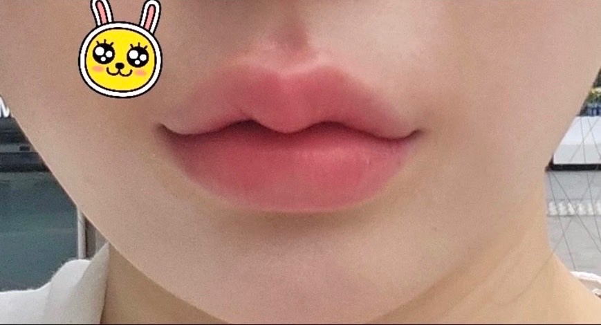 Qちゃん🫧 tweet media