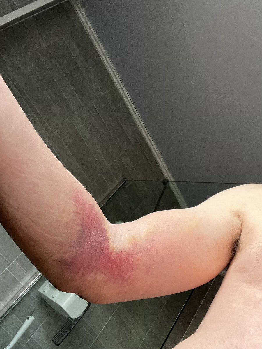 Wilgy 🇪🇺 tweet media