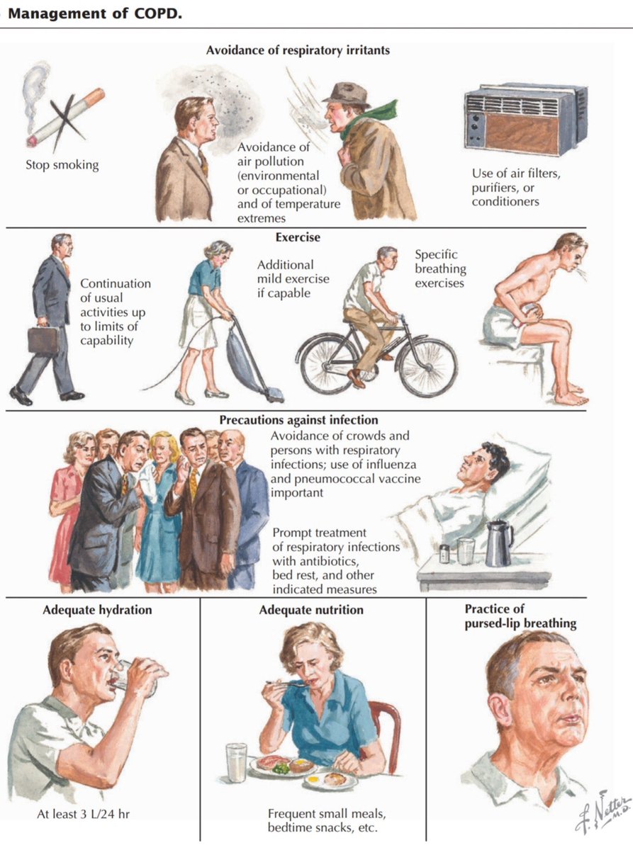 bhaskarhaz3's tweet photo. COPD https://t.co/EcLJxoUMHW