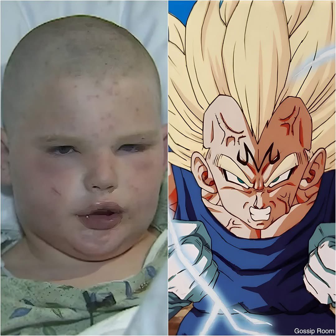 GossipRoomOff's tweet image. 🚨 Un enfant survit à plus de 400 piqûres d'abeille grâce à une technique qu'il a apprise de son personnage d'animé préféré, Vegeta !

Au Texas, le 31 janvier 2026, Andrew Kunz, 11 ans, a survécu à l’attaque de plus de 400 abeilles africanisées après qu’un nid lui soit tombé