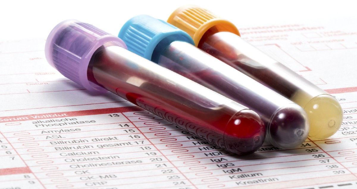 WebMD's tweet photo. It's the morning of your bloodwork and your doctor said to fast before the test. Your stomach is growling, but don't eat! Your results could come back wrong if you give in to temptation. Learn why: https://t.co/p91OeRv5Bh https://t.co/lXtj8iXFBn