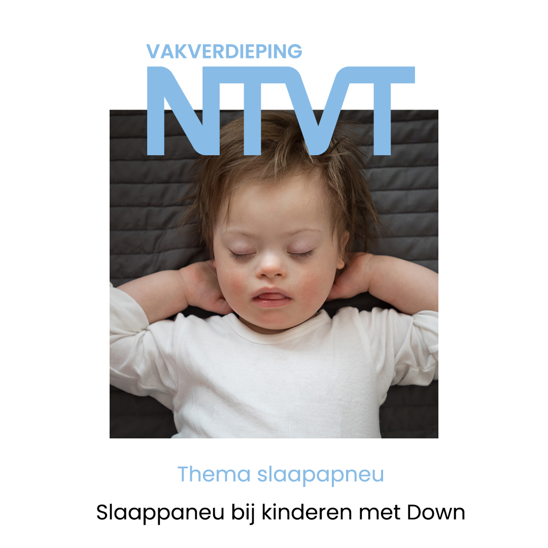 NTVTredactie's tweet image. Obstructieve slaapapneu komt vaak voor bij kinderen met het syndroom van Down. Vroege diagnostiek en passende behandeling zijn cruciaal, maar bewijs voor effectiviteit blijft beperkt. 

Lees meer: doi.org/10.5177/ntvt.2… 

#OSAS #Downsyndroom #kinderzorg #mondzorg