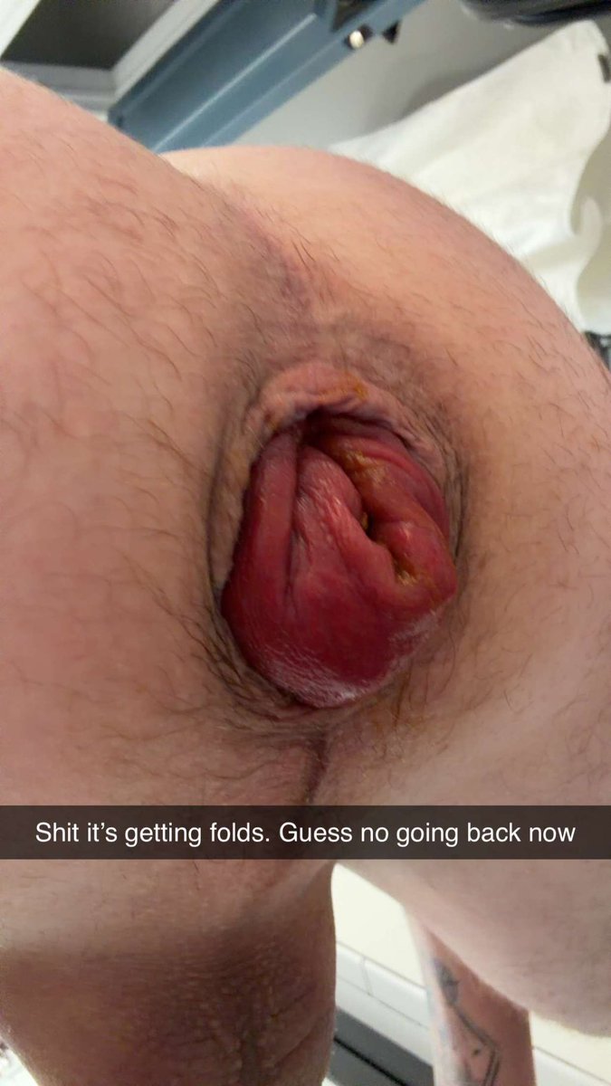 funbttmff tweet media