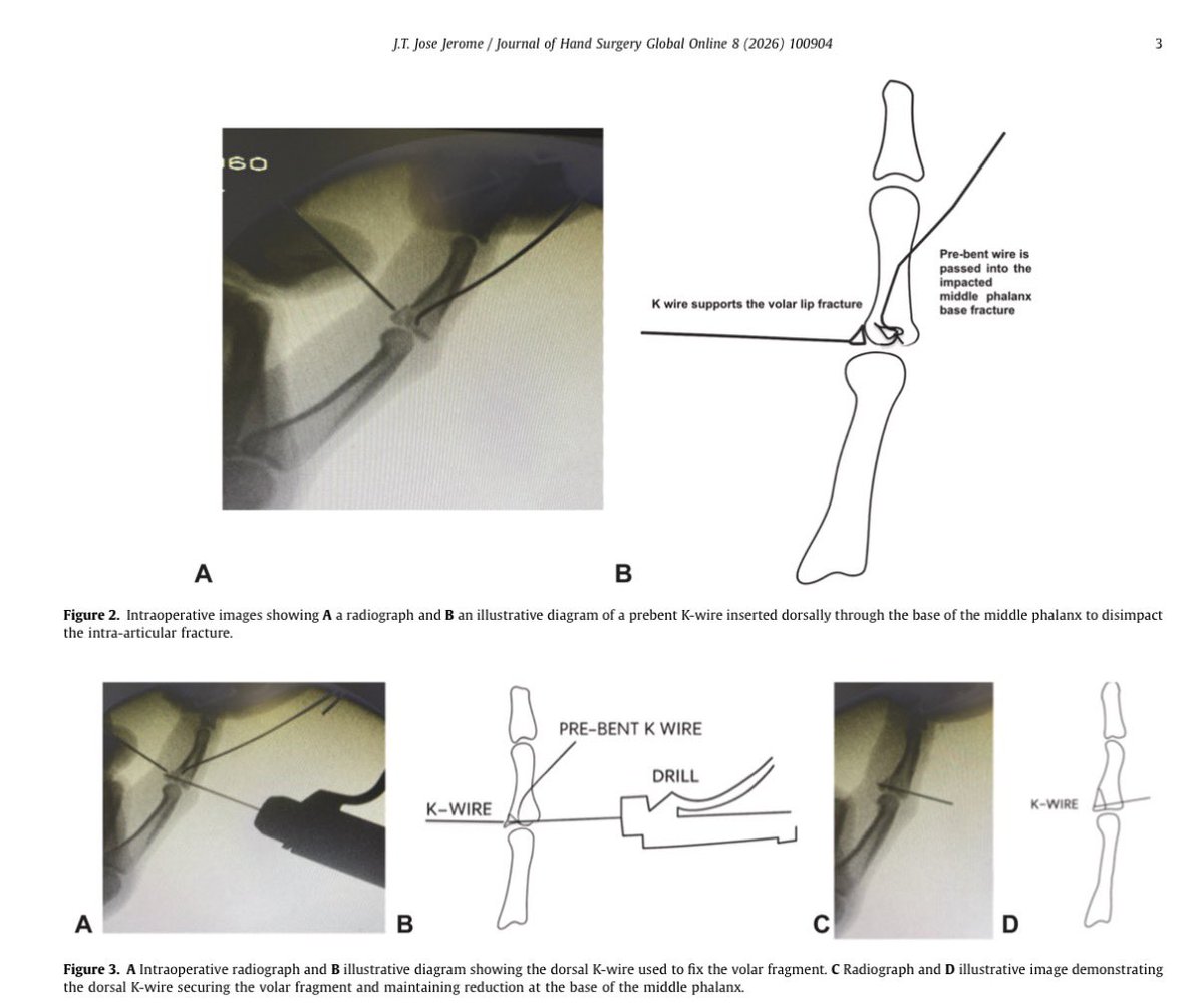 Terrence Jose Jerome, FRCS tweet media