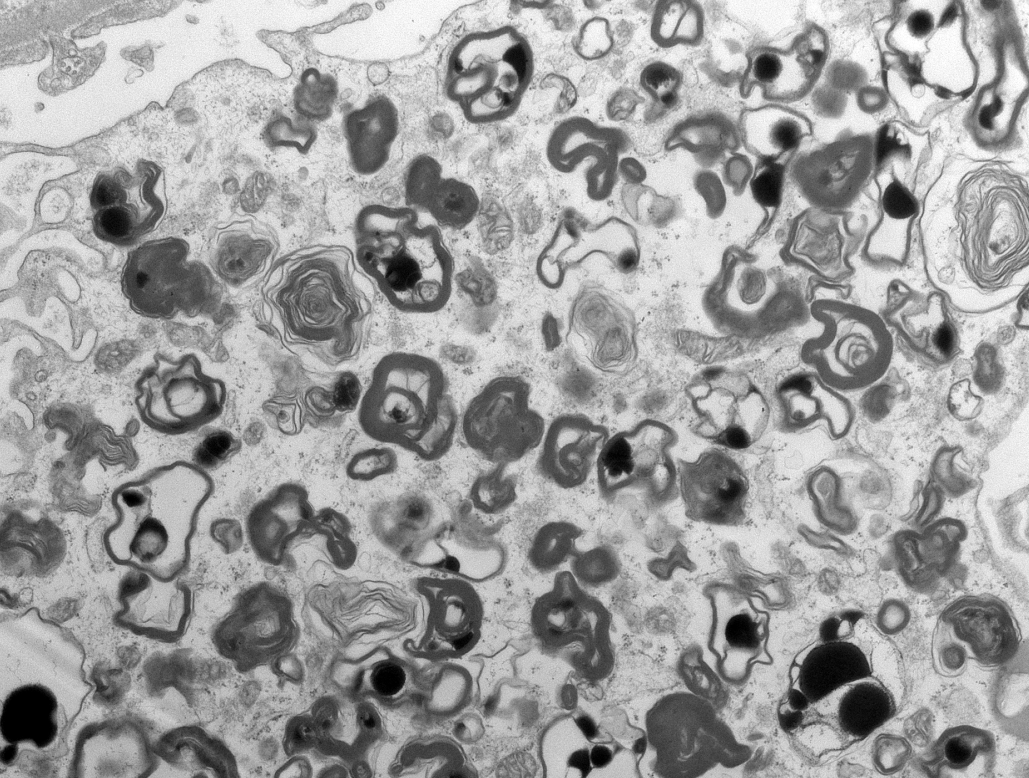 Jonathan Zuckerman MD PhD tweet media