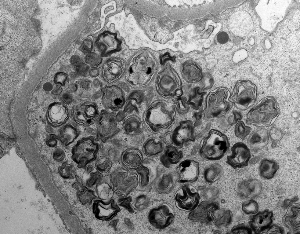 Jonathan Zuckerman MD PhD tweet media