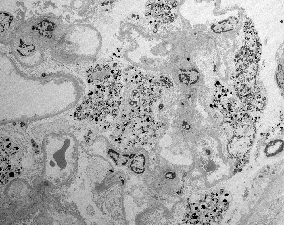 Jonathan Zuckerman MD PhD tweet media