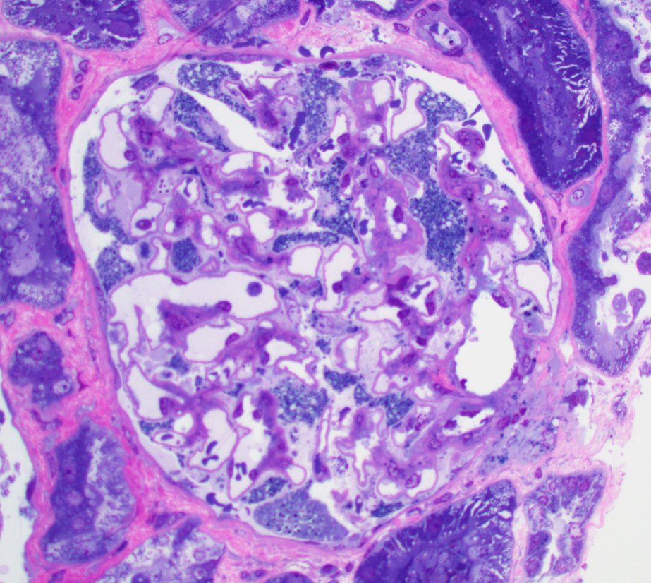 Jonathan Zuckerman MD PhD tweet media