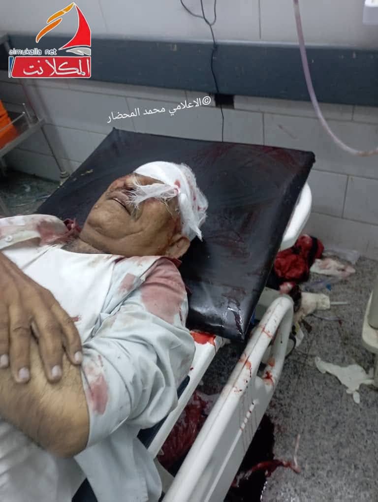 لن تذهب دماء الشهداء والجرحى  الجنوبيين هدرآ ايها المحتل انتم امام شعب ابطال جبار شعب عظيم لايرتضي بالمحتل والذل والمهان 
من أحد المستشفيات في عدن سقوط اول شهيد ببوابة معاشيق متأثراً بجراحه ارتقى شهيد بأذن الله
لا حول ولا قوه إلا بالله العلي العظيم