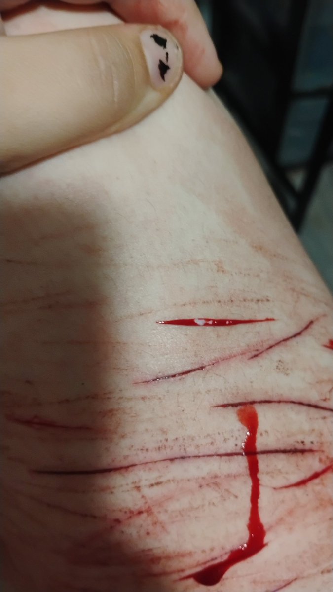 delusettes's tweet photo. hi some cuts i did a few days ago.. ignore my fat leg. #shtwt #shedtwt #sh3dtwt https://t.co/Oa02q6s1fI