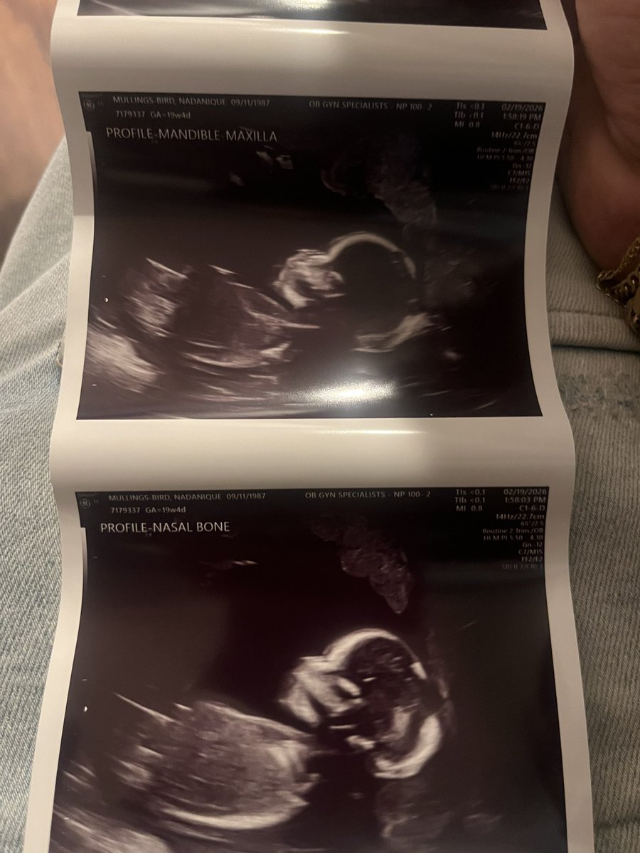 448err's tweet image. Havin a girl…😐, still a blessing, but i already know she gon stress df out me😭 ain gettin no phone till she graduate high school, IM PICKIN all her mtf outfits from da start of elementary  till she move tf out my house.