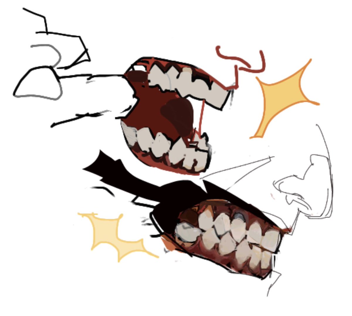 Can you guess what dental restorations my character has had 😳🦷