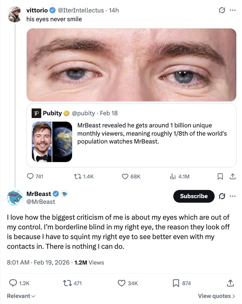 DramaAlert's tweet image. MrBeast revealed he is BLIND nearly in one of his eyes.