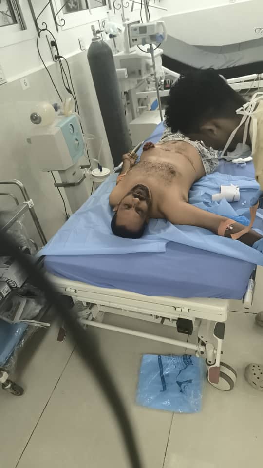 #عاجل |
صور تظهر مصابين من المتظاهرين جراء إطلاق النار عليهم قبالة مقر الحكومة في معاشيق بعدن
#south24