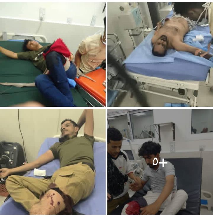 بأي شريعة يُقدم دم الجنوبي قرباناً لمن استبدل بندقيته بحقيبة سفر؟ عدن التي سحق أبطالها الغزاة لن تكون مأوى لوزراء 'كرتون' غسلوا عار هزيمتهم بدموع النزوح وسقطت رجولتهم عند أول طلقة في ديارهم .. 👌🏻

جرحى برصاص حراسه قصر المعاشيق شفاهم الله وعافاهم .