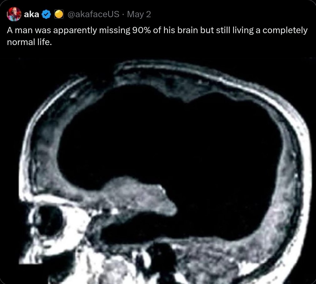 pasinaDambudzo's tweet photo. @matinyarare Forgive Rutendo Matinyarare, for he doesnt know what he is doing 🧠✖️‼️#ediot https://t.co/c1gNlrQc2j