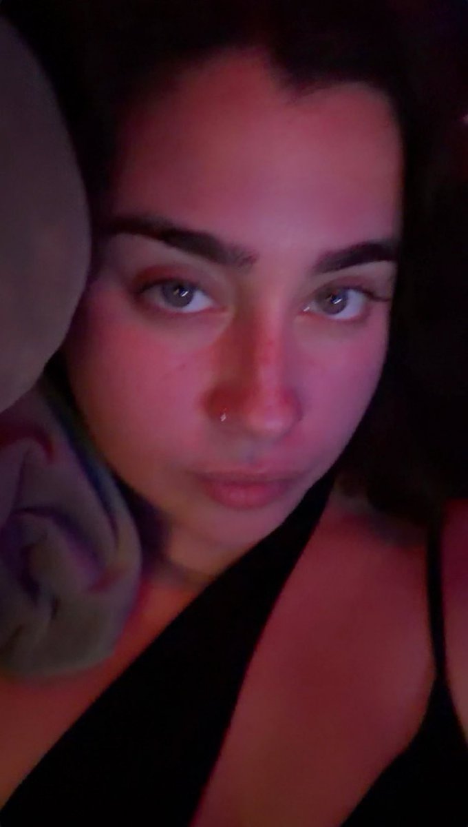 lauren jauregui mais vermelha que um camarão a bicha não quis usar protetor 😭😭😭 deve tá tão enfadada cansadinha quietinha descansando