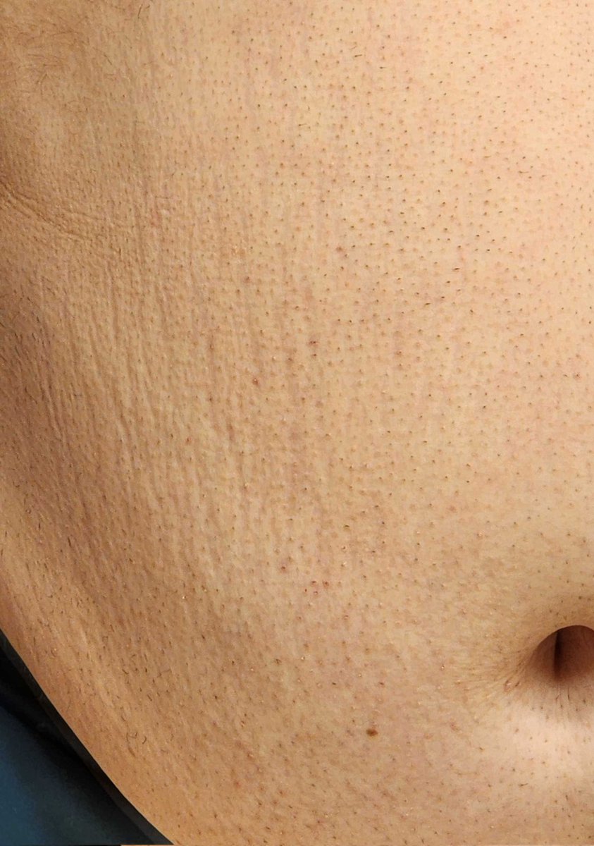 I'm proud of my stripes💜💜