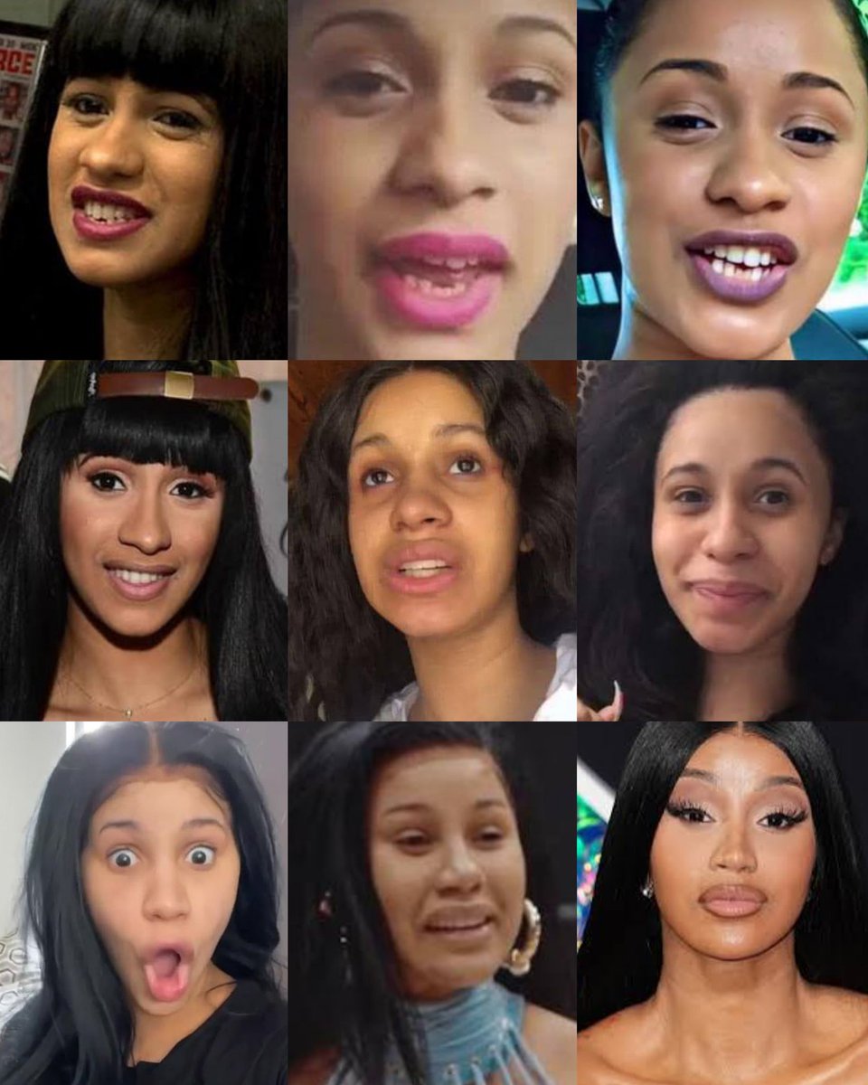 One thing about these Botchigangs is that they’re always projecting everything they accuse others of bcuz I know damn well they’re the last people who should be talking about someone having a botched face when their fav’s face has been shapeshifting for years. 🎭🤣🤣🤣