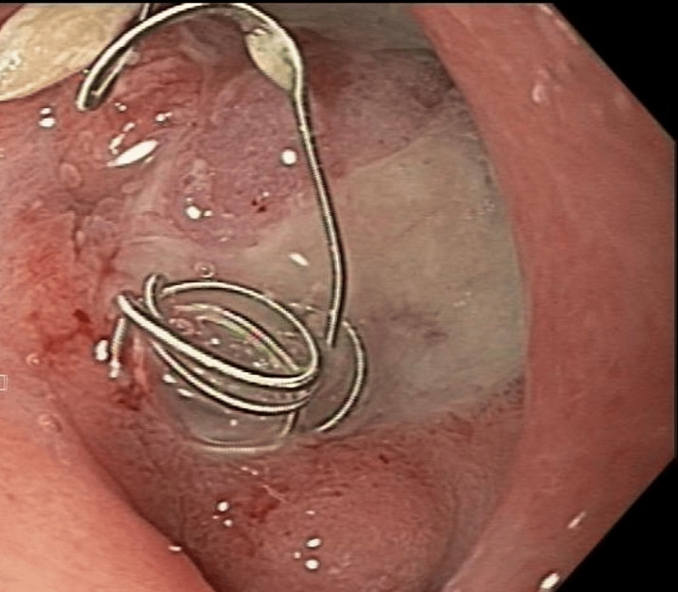 Keith Siau tweet media