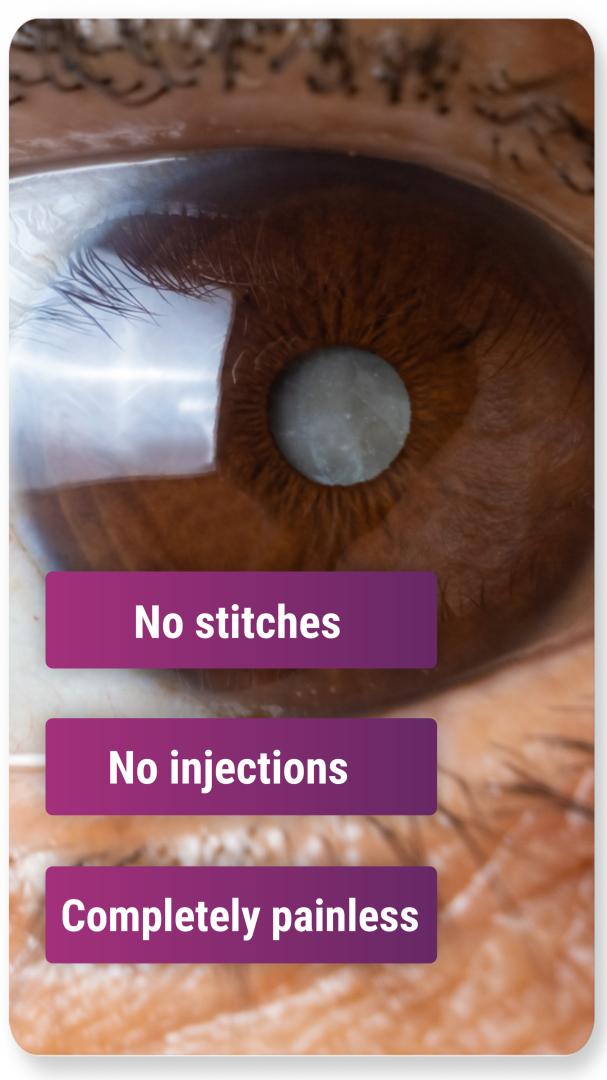 👀 50+ में नजर कमजोर? जानिए Cataract का आसान इलाज!✅ Cataract Surgery Review 
.
.
#Cataract #CataractSurgery #EyeSurgery #BlurredVision #EyeCare #PatientReview #Ghaziabad #EyeHospital #HealthyEyes #DrHarishGupta #Shorts 
youtube.com/shorts/4yYMy5i…