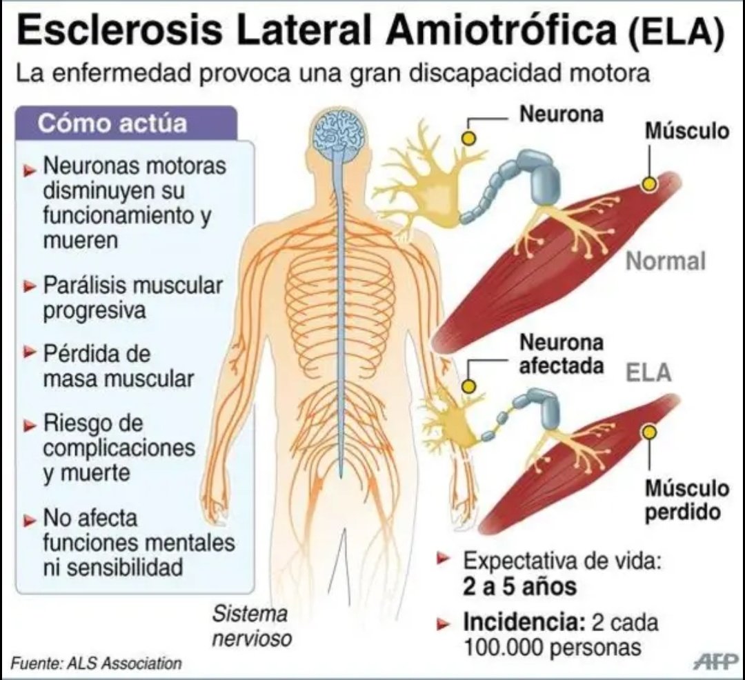 El actor Eric Dane muere a los 53 años a causa de esclerosis lateral amiotrófica (ELA). El inolvidable Dr. Mark Sloan en la serie Grey's Anatomy. Buen viaje 🕊 

Aquí les dejo detalles de esta terrible enfermedad