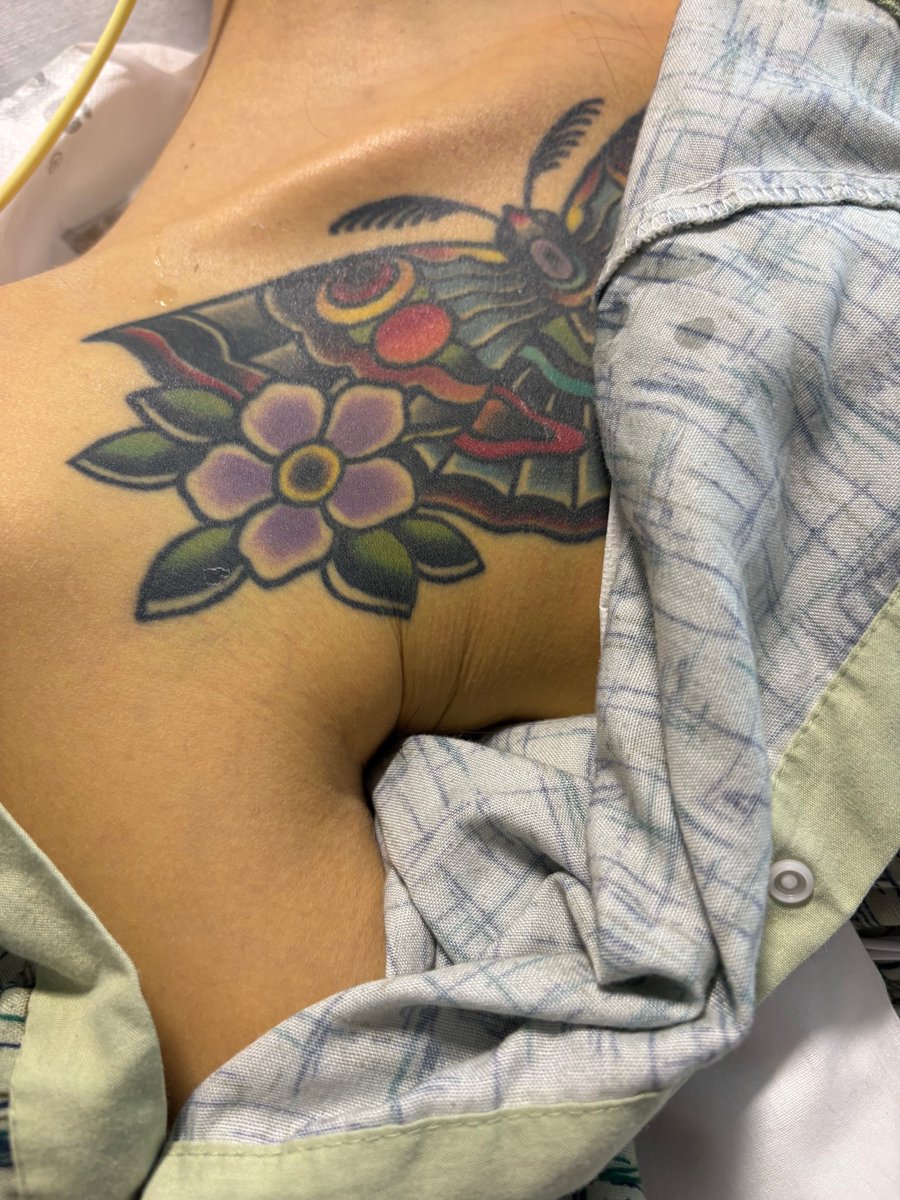 KSL5TV's tweet image. JUST IN: A Salt Lake City hospital is asking for the public’s help identifying a man it said was brought in with no documentation or evidence of his identity.

Learn more: ksltv.com/?p=879859

🖊️ : Devin Oldroyd
📷: CommonSpirit Health