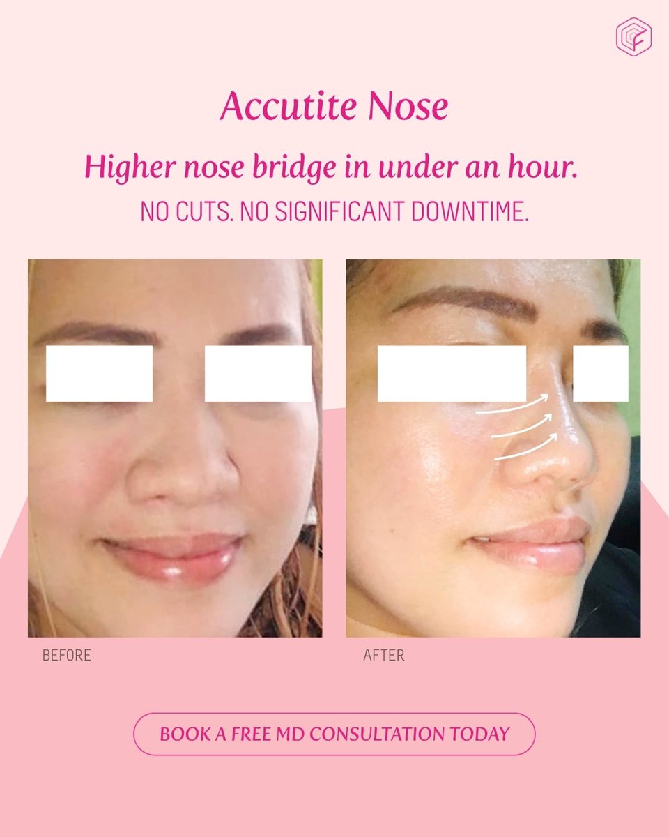 Flawless Face & Body Clinic tweet media