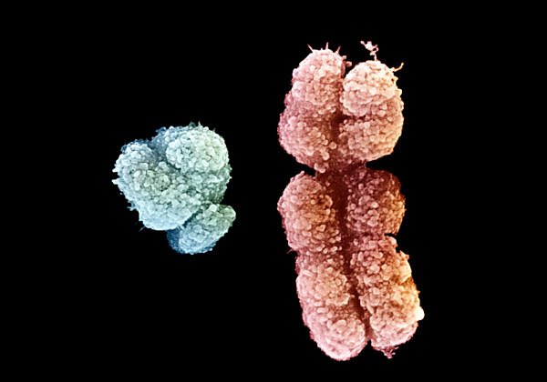 forallcurious's tweet image. 🚨: Study shows that Y chromosome in men is disappearing. It could lead to the end of male births in the future