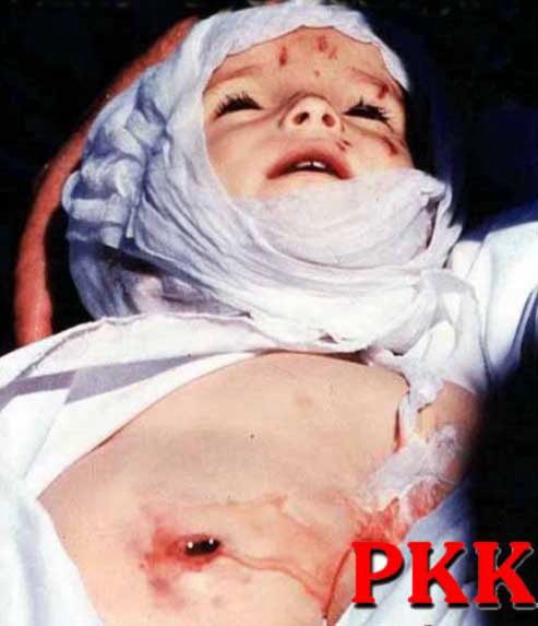 <a href="/NaimBaburoglu/">Dr. Naim Babüroğlu</a> Gördüğümde göz yaşlarımı tutamamıştım
Buna sebep olanların umut hakkı olamaz 
bu bebeğin geri gelme ihtimali var mı ki 
umut hakkı olsun