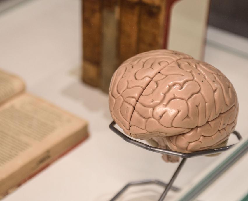 Uno de cada tres pacientes con epilepsia presenta resistencia a los tratamiento. 🧠 Especialistas se reunirán en el <a href="/cuvallesudg/">CUValles UdeG</a> para analizar la farmacorresistencia, nuevas terapias, biomarcadores para mejorar su atención. 

🔗 url.udg.mx/a0FJO