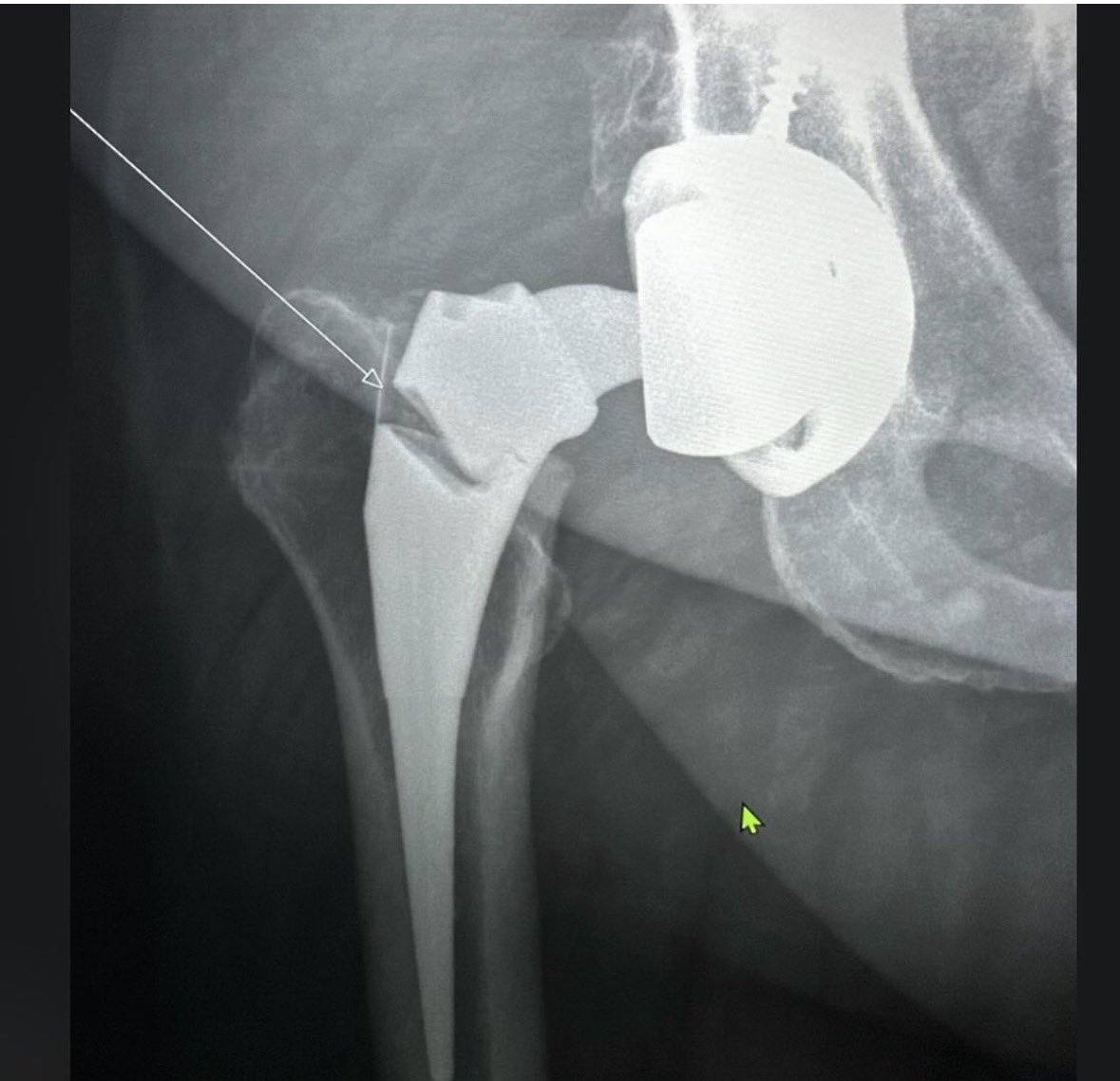 disasterplasty tweet media