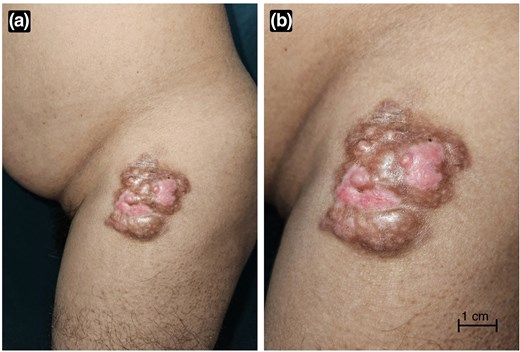 Skin Health and Disease tweet media