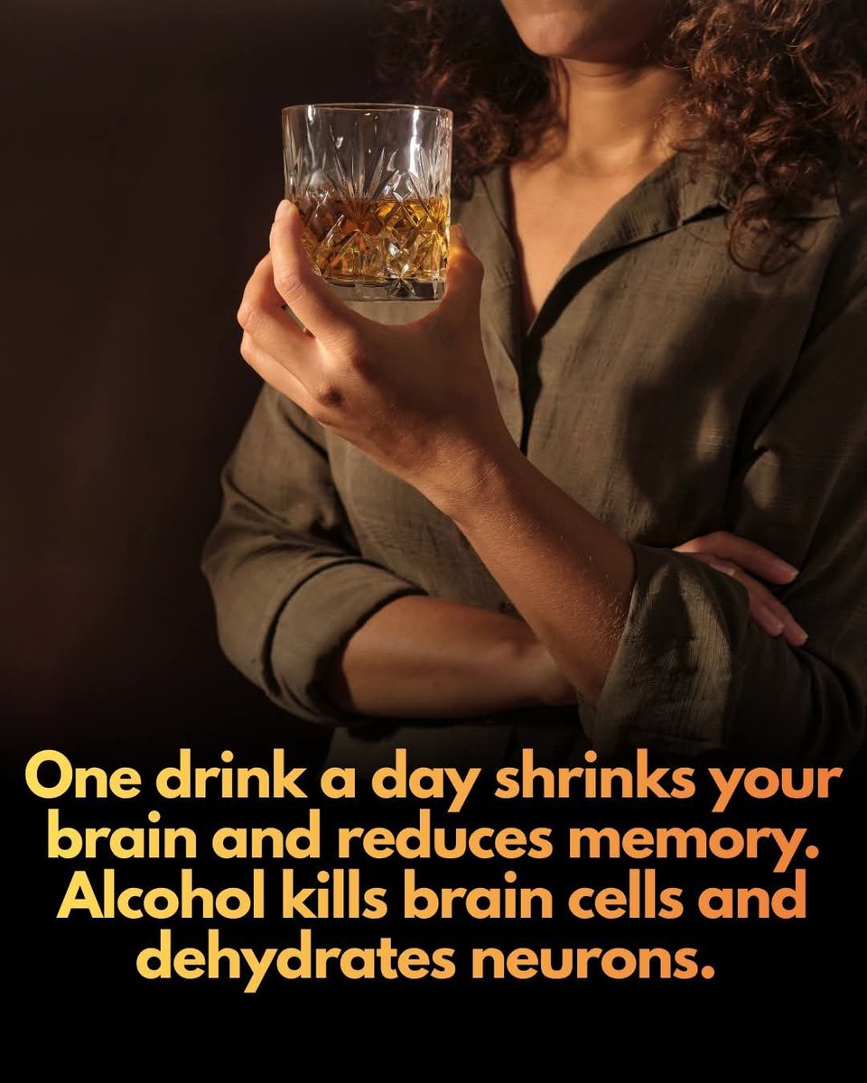 ShiningScience's tweet photo. 🚨 New research shows even a single daily alcoholic beverage physically shrinks your brain and accelerates aging by years.

Recent large-scale studies are overturning the long-held belief that moderate drinking is harmless, or even beneficial. A massive analysis of over 36,000 adults found that even light-to-moderate alcohol consumption—equivalent to one pint of beer or a single glass of wine per day—is directly linked to a reduction in overall brain volume. These changes affect both gray and white matter, with the hippocampus, a critical hub for memory and learning, being particularly vulnerable. Scientists warn that moving from one to two drinks a day can cause structural changes equivalent to aging the brain by two full years, leading to cognitive decline and increased "brain fog."

Beyond physical shrinkage, alcohol acts as a potent neurotoxin that damages the dendrites at the ends of neurons, effectively hindering the brain's ability to communicate internally. While chronic use is most damaging, the diuretic nature of alcohol also causes immediate dehydration of neurons, impairing mental clarity. However, there is a silver lining for those looking to protect their cognitive health: research suggests that the brain possesses a remarkable capacity for recovery. By reducing or eliminating alcohol consumption, individuals can allow their brain to regain some lost volume and repair vital neural connections, potentially halting or even reversing some of the damage caused by exposure.

Source: Daviet, R., Aradhye, H., Litt, G. W., & Nave, G. Associations between alcohol consumption and gray and white matter volumes in the UK Biobank. Nature Communications.