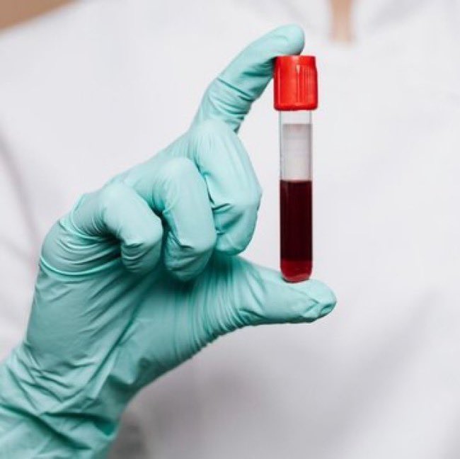 Bu büyük bir devrim olacak,

🚨 : Japonya, tüm kan gruplarıyla uyumlu evrensel yapay kan geliştirdiğini duyurdu…