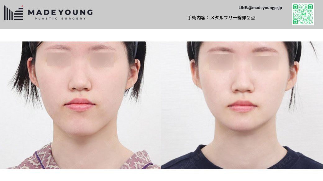 ［公式］メイドヤング美容外科 tweet media