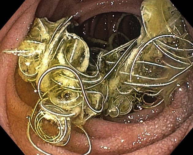 Keith Siau tweet media