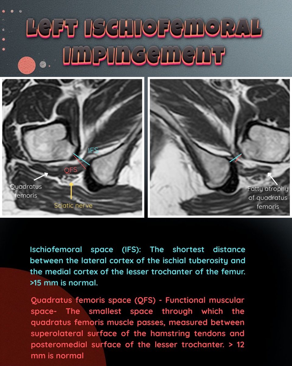 MSS India tweet media